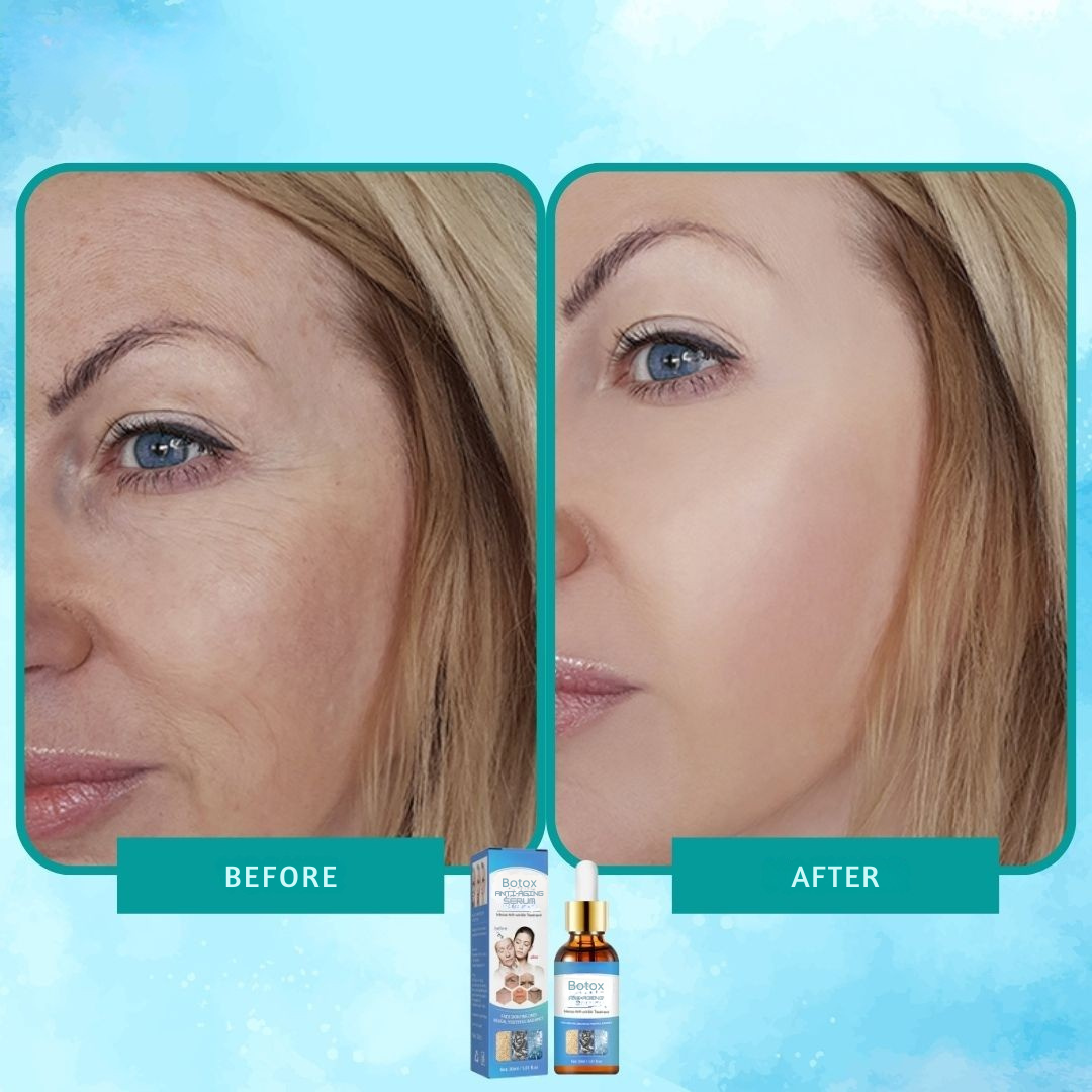Sérum botox élixir anti-rides intense pour une peau lissée