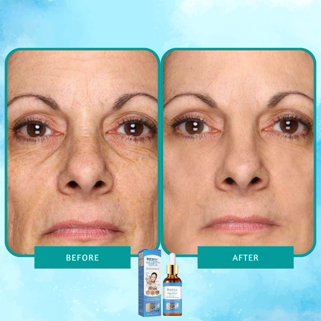 Sérum botox elixir anti-rugas intenso 