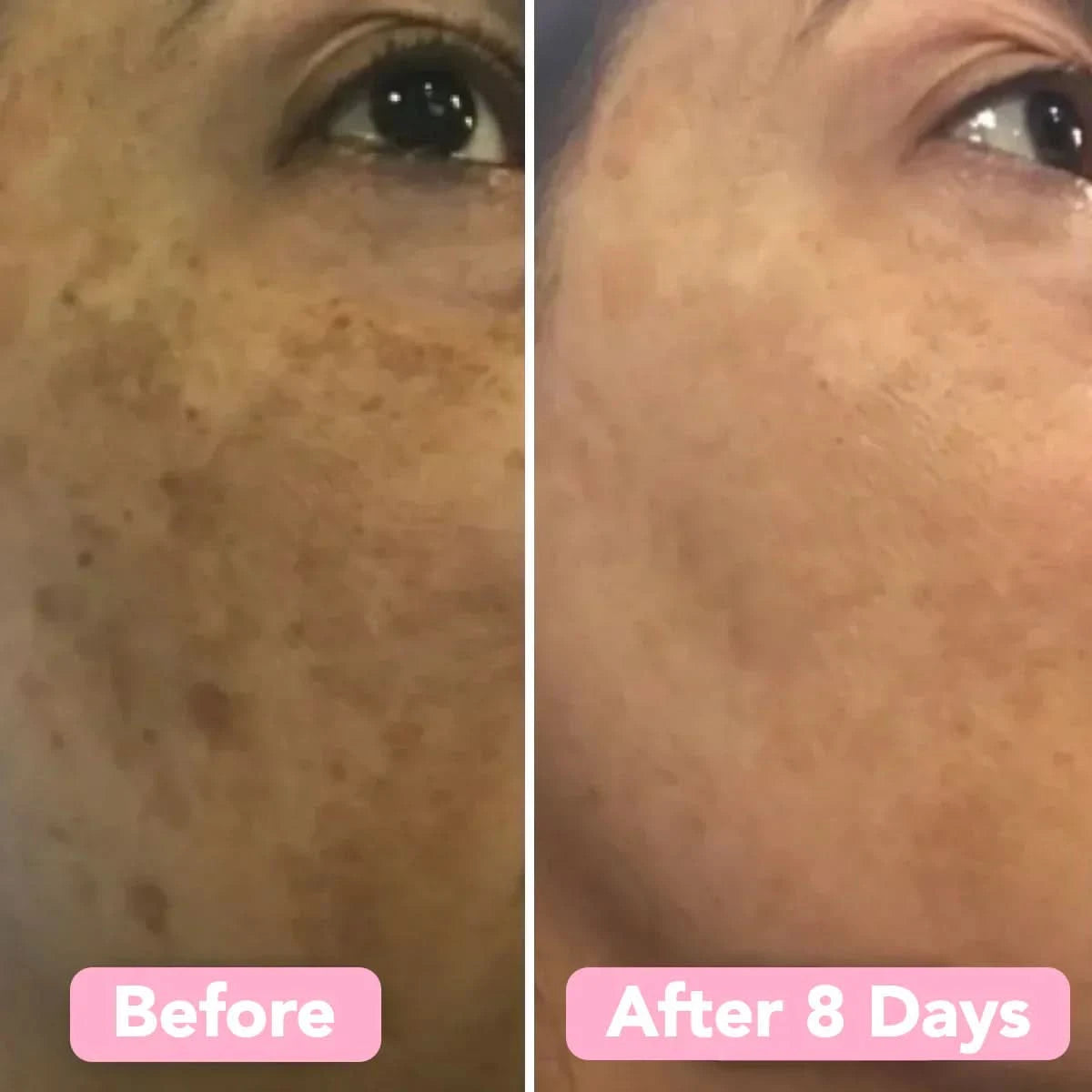 Esponja de cúrcuma – Piel limpia y purificada naturalmente (x40) 